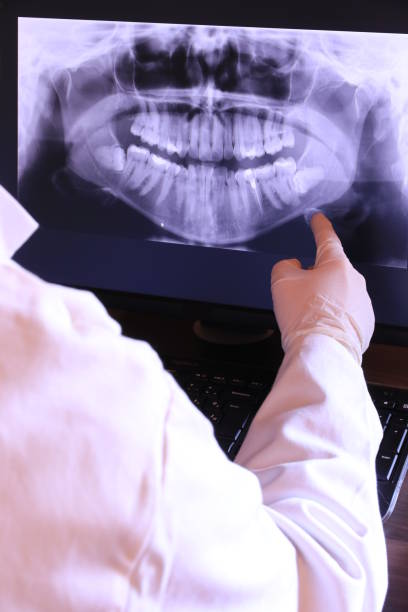 Best Emergency Dentist for Lost Fillings or Crowns in Channelview, TX