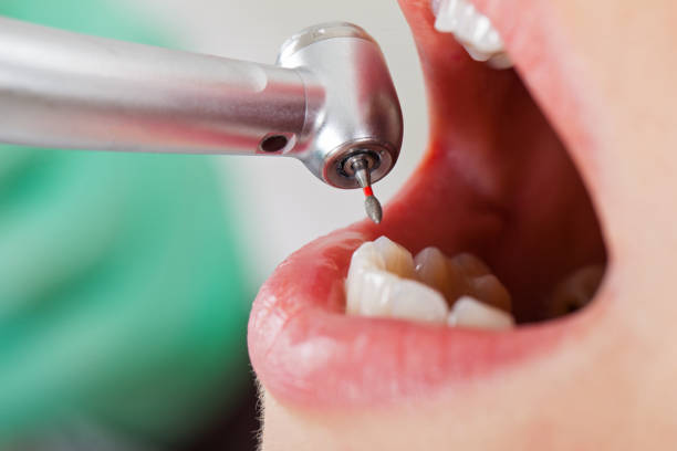 Best Emergency Dental Services for Seniors in Channelview, TX